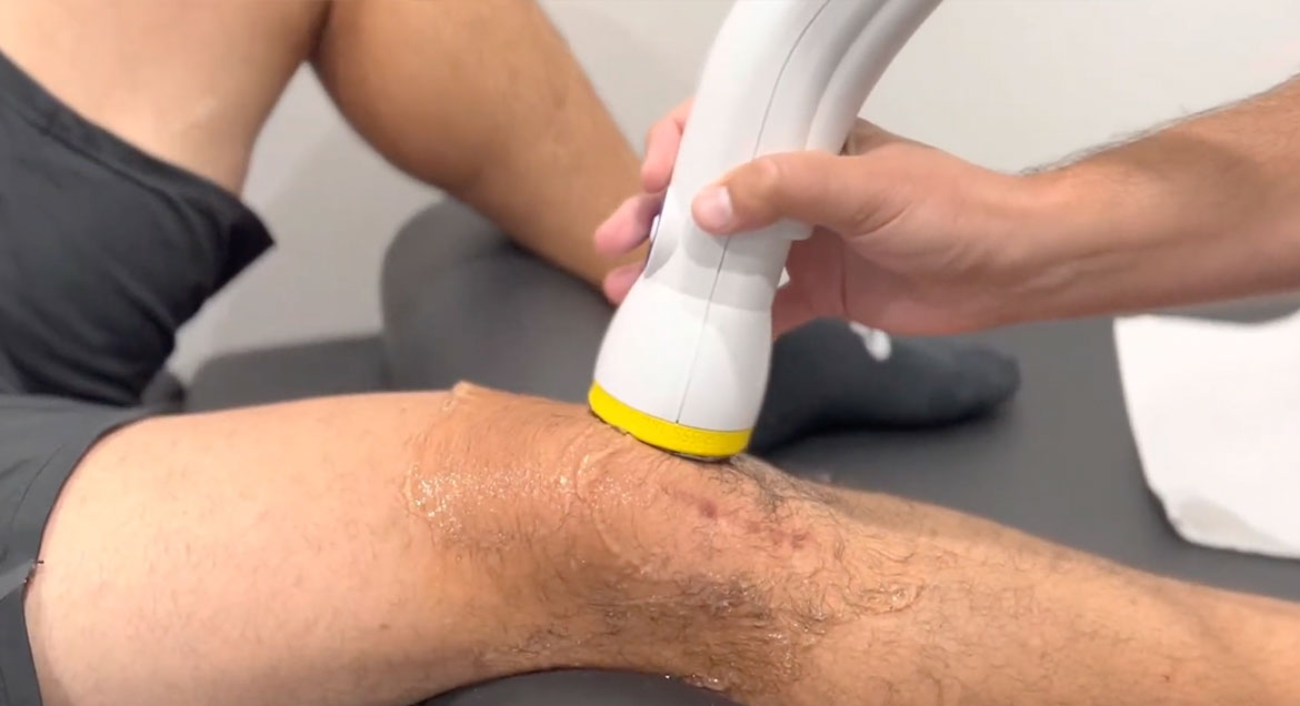 Transforming Knee Arthritis Treatment with SoftWave Therapy in Dallas, TX